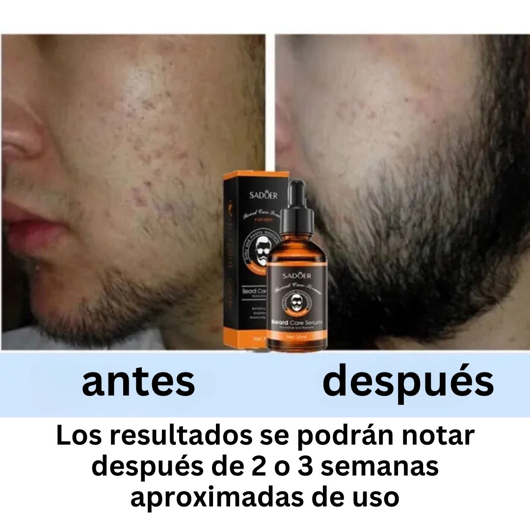 SERUM Tónico para el crecimiento de Barba (1 frasco de 30 ml.)
